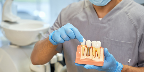 Dental Implant